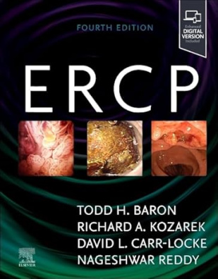 ERCP