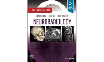 Neuroradiology: Core Requisites 